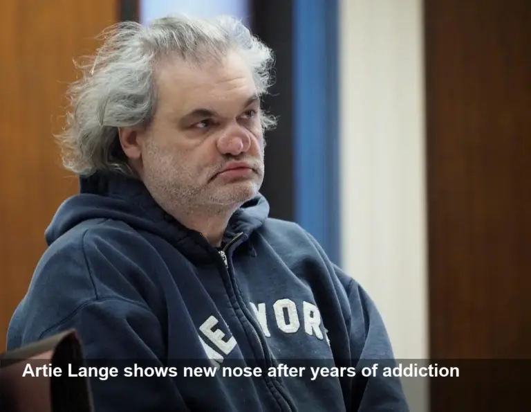 Artie Lange’s dramatic nose transformation revealed
