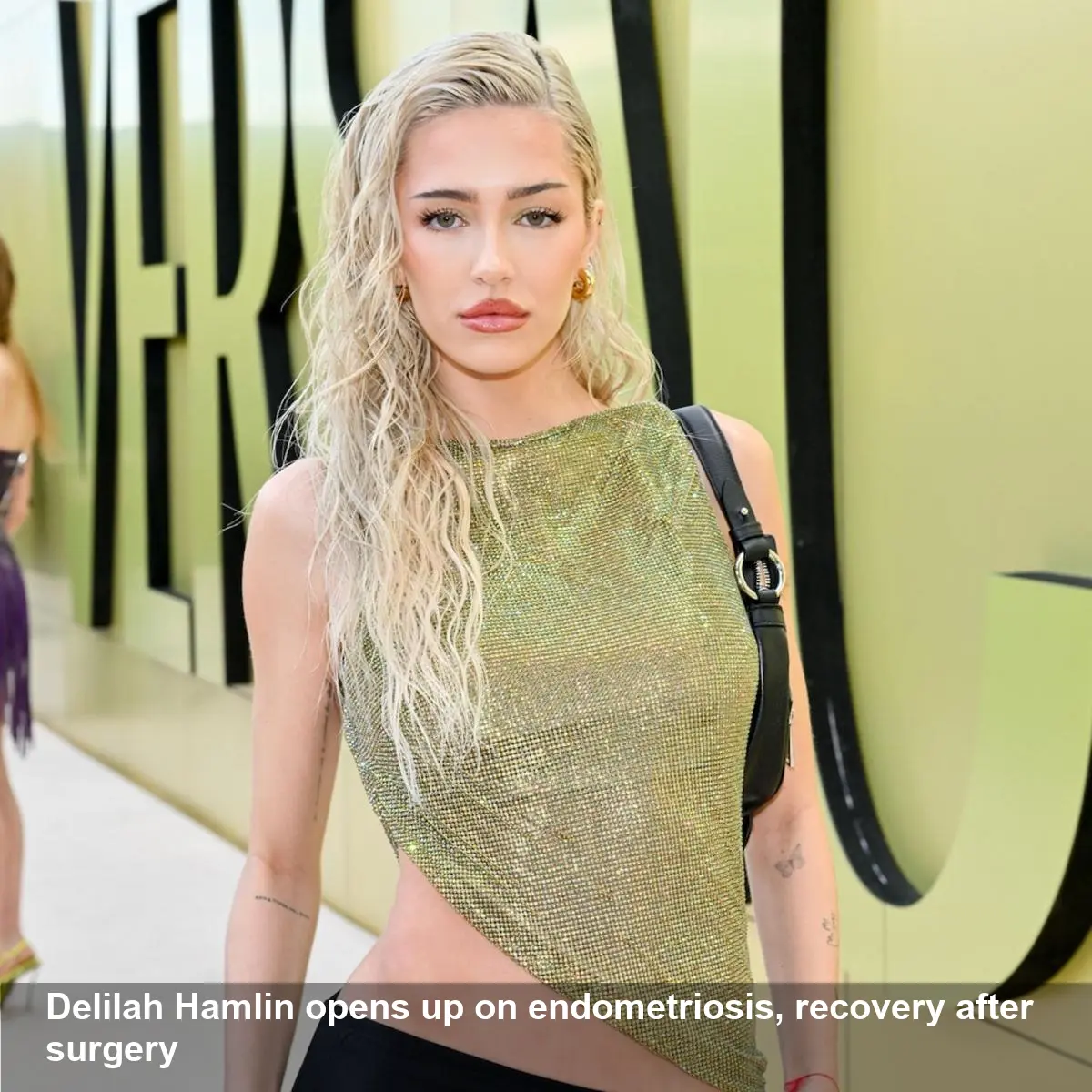 Lisa Rinna’s Daughter Details Painful Endometriosis Surgery